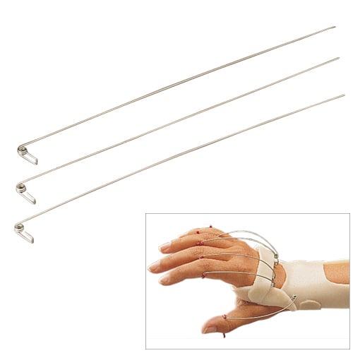 Finger Extension Assists