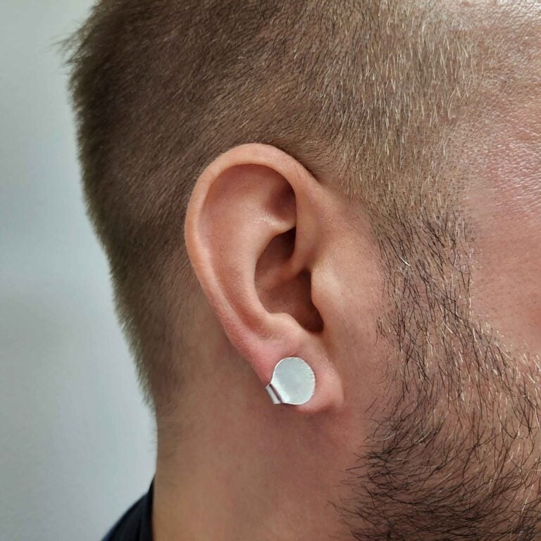 Hopeinen korvalasta keloidin hoitoon